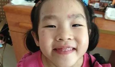 病毒带状疱疹水痘会传染吗_病毒带状疱疹水痘几天能好_水痘病毒 带状疱疹·