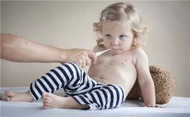 病毒带状疱疹水痘会传染吗_病毒带状疱疹水痘几天能好_水痘病毒 带状疱疹·