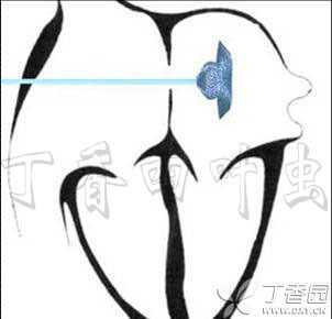 虫哥说图系列5_虫哥现身_虫哥b站