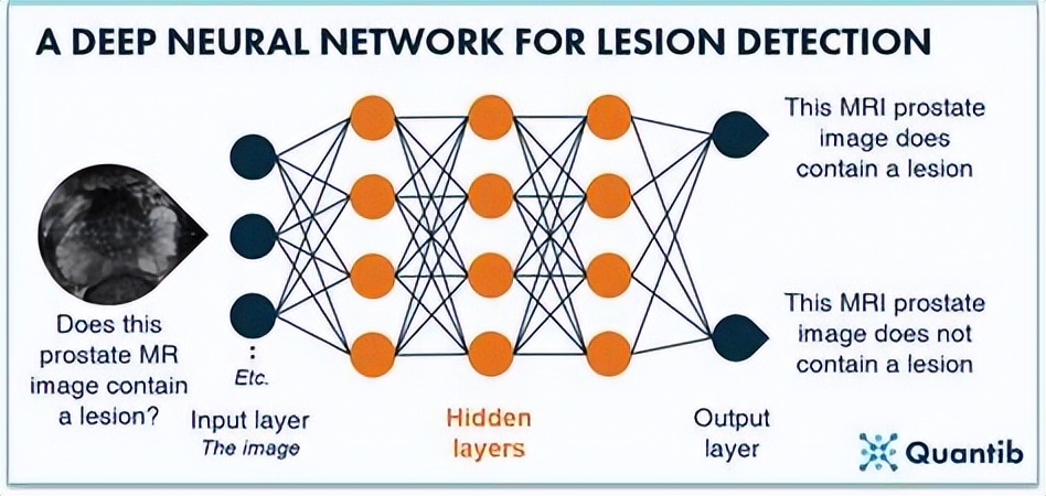 卷积神经网络入门教程_卷积在生活应用_卷积神经网络基本概念
