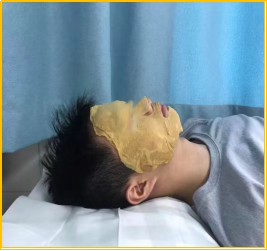 痤疮专病门诊_广州市天河区中医医院皮肤科_皮肤病医院 去除青春痘