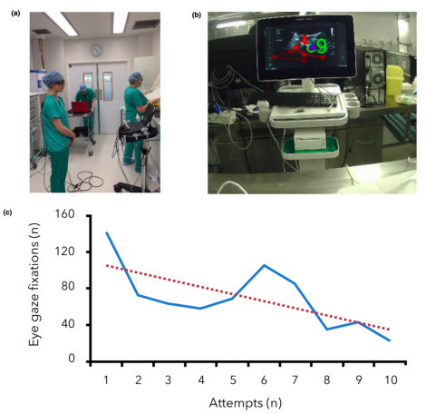 卷积的应用实例_卷积在生活应用_卷积在生活中的应用