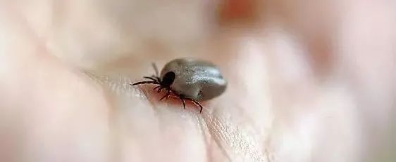 新型布尼亚病毒感染症状_脾虫咬后的伤口图_蜱虫叮咬预防