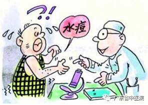 成人水痘症状严重_成人得水痘原因_水痘病毒 体内
