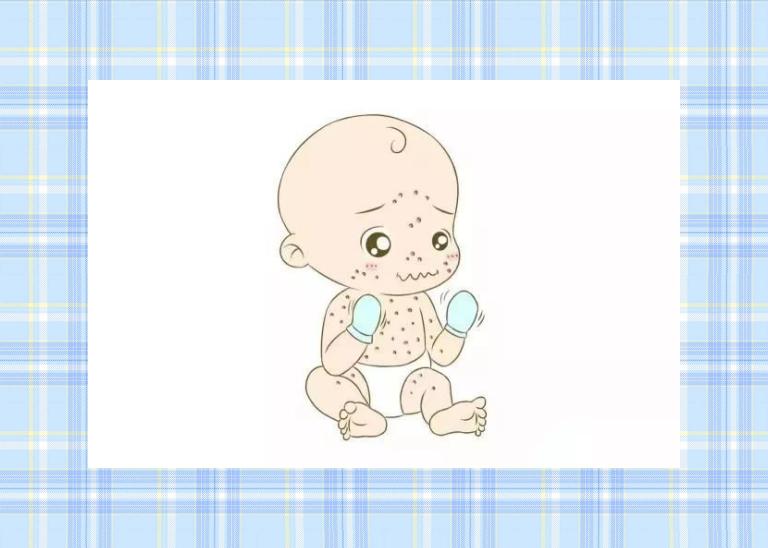 水痘疫苗接种流程_春季预防水痘最有效方法_水痘病毒 体内