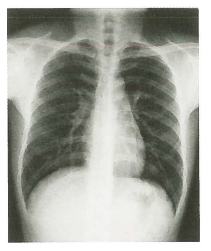 镜子反射原理生活应用_应用挂载器原理_听诊器原理生活应用