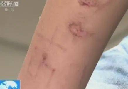 有关蓝鲸游戏新闻_关于蓝鲸的新闻报道_关于前几年有关蓝鲸的游戏视频